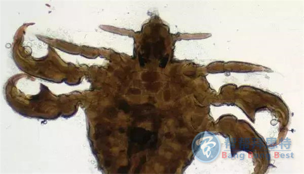 殺蟲(chóng)公司帶你生活中十五種寄生蟲(chóng)
