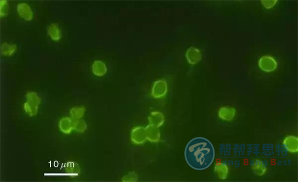 殺蟲(chóng)公司帶你生活中十五種寄生蟲(chóng)