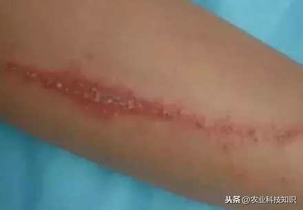 這蟲(chóng)子可是個(gè)狠角色，惹不起，躲著走