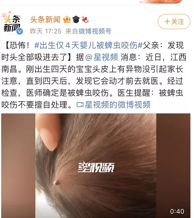 家中的小孩被蜱蟲咬了怎么辦？如何對付蜱蟲？